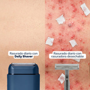 ✨ NUEVA Daily Shaver® – Rasuradora Facial MyHUEVOS®