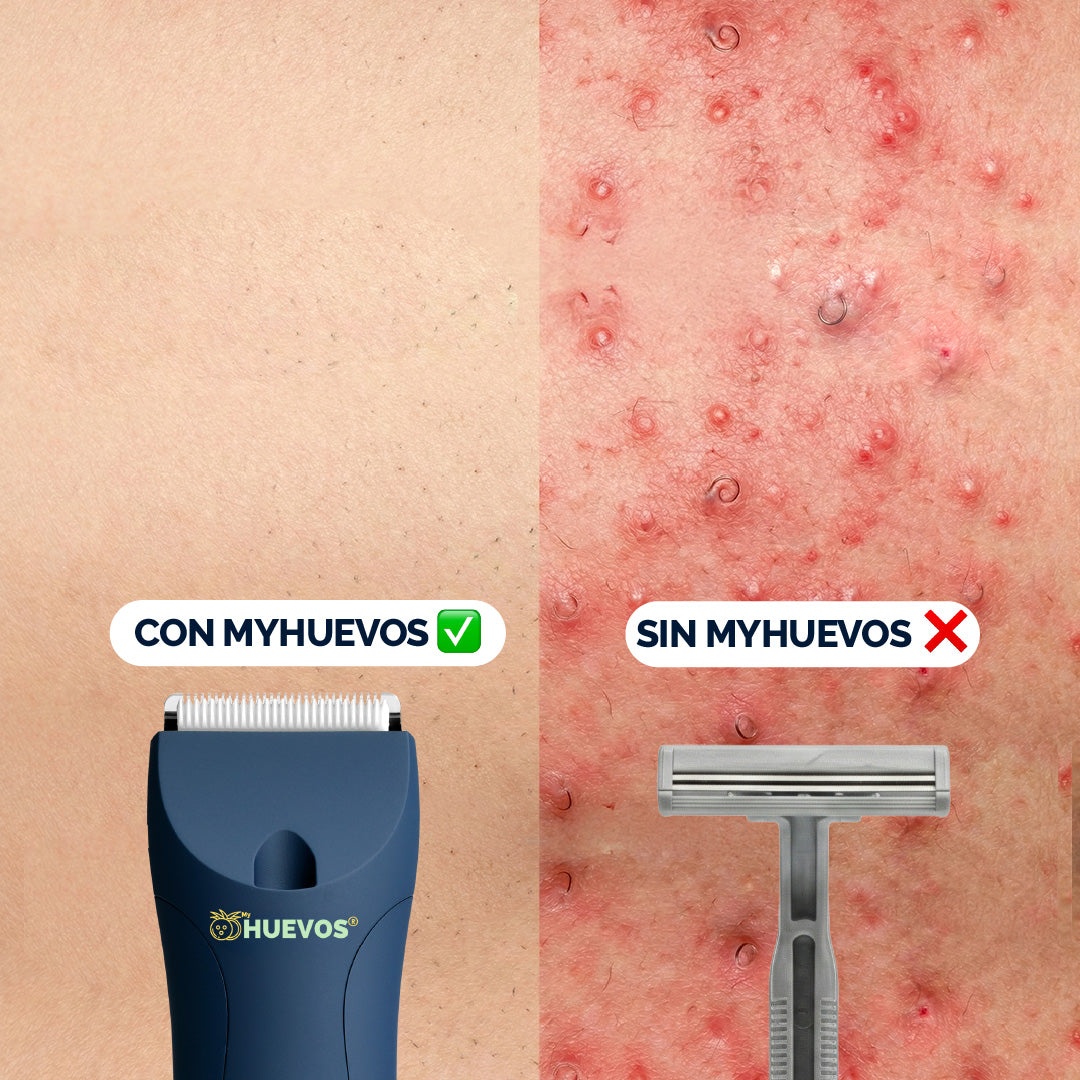 Rasuradora MyHUEVOS® 4.0