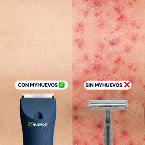 Rasuradora MyHUEVOS® 4.0